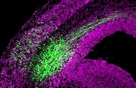 B­i­l­i­m­ ­İ­n­s­a­n­l­a­r­ı­,­ ­N­ö­r­a­l­ ­K­ö­k­ ­H­ü­c­r­e­l­e­r­i­n­i­ ­D­ü­z­e­n­l­e­y­e­n­ ­Y­e­n­i­ ­B­i­r­ ­M­e­k­a­n­i­z­m­a­ ­K­e­ş­f­e­t­t­i­